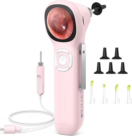 Otoscopio Digital ScopeAround