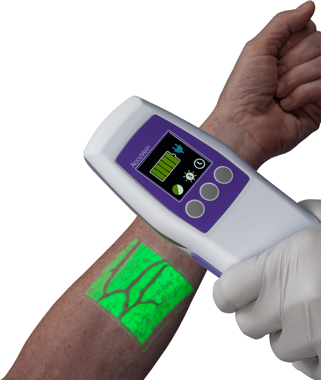 Sistema de Visualización de Venas AccuVein AV500