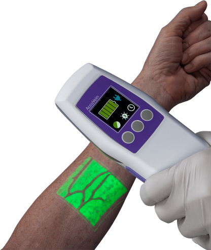 Sistema de Visualización de Venas AccuVein AV500
