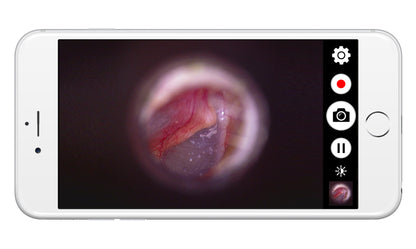 Videotoscopio Movil Inalámbrico HD