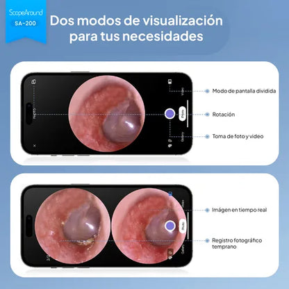 Otoscopio con Camara 4.3mm, con pantalla 1.85" WiFi Compatible con Android/iPhone