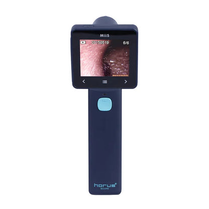 Otoscopio Digital EZ-Horus OTO Blue