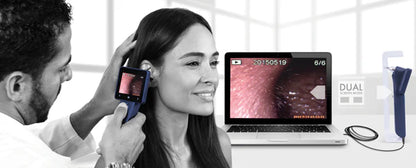 Otoscopio Digital EZ-Horus OTO Blue