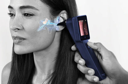 Otoscopio Digital EZ-Horus OTO Blue