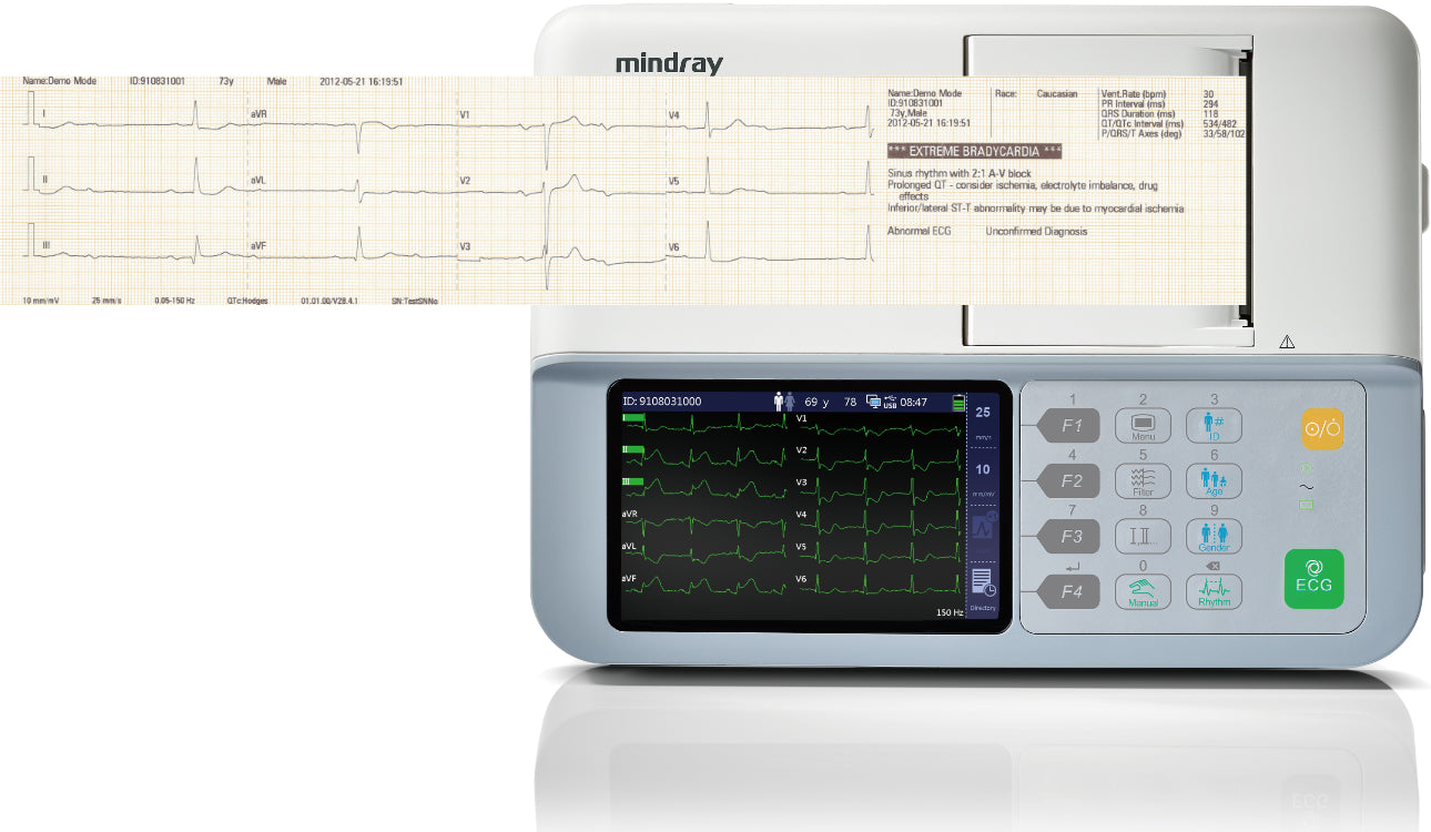 Electrocardiógrafo Mindray BeneHeart R3